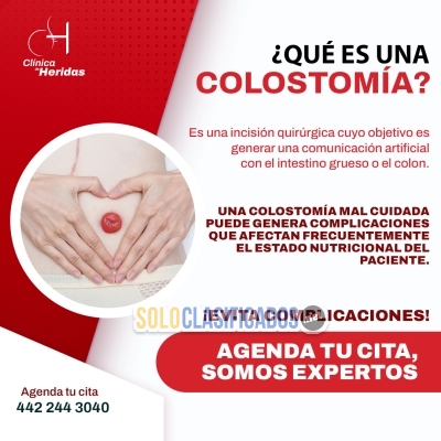 ¿Necesitas un cuidado especializado para tu colostomía?... 