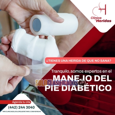 CURACION Y MANEJO CORRECTO DE PIE DIABETICO... 