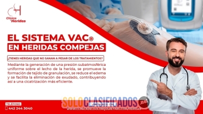 EL SISTEMA VAC Y SU USO EN HERIDAS COMPLEJAS... 