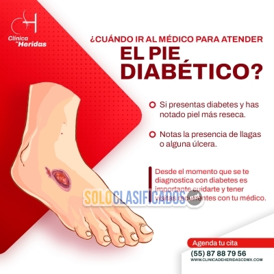 ¿Sabías que el pie diabético puede prevenirse con atención tempra... 