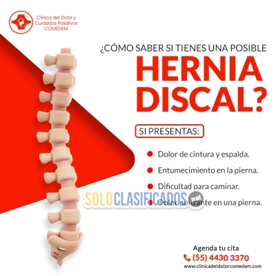 ¿Dolor intenso en la espalda que se irradia hacia tus piernas?... 